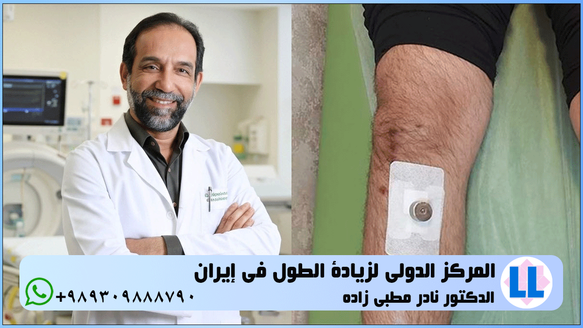 جراحة زيادة الطول